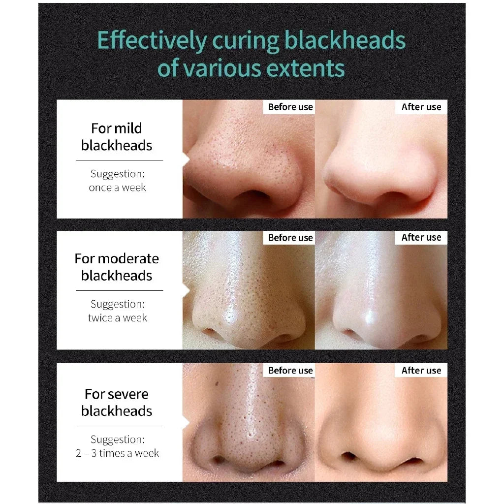 Blackhead Remover Nose Black Mask Face Care Mud Peel off Mask Skin Care 50G