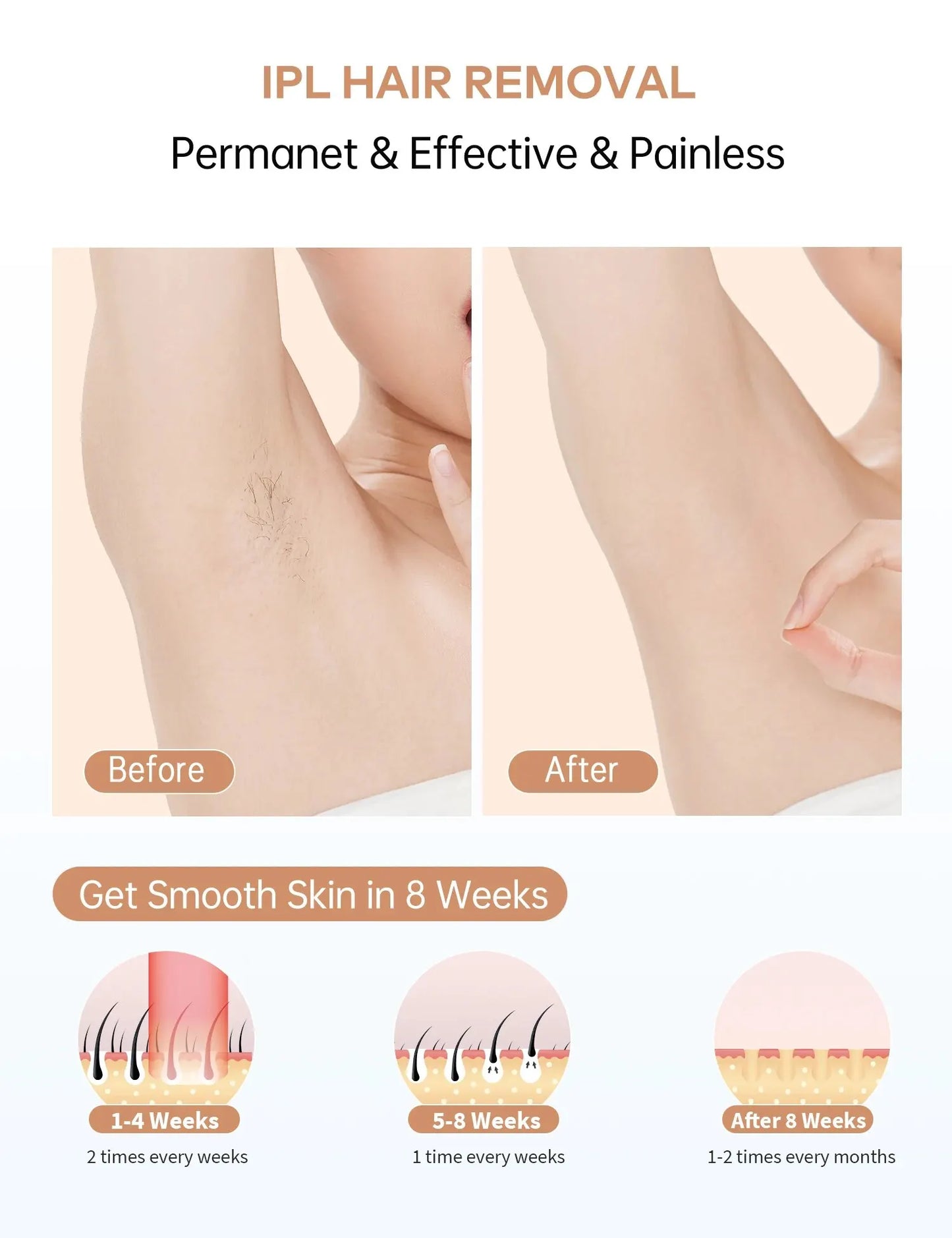 IPL Devices Hair Removal Laser 999900 Light Pulses HR/ SC /RA 9 Levels Whole Body Painless Hair Removal Home Use for Men Women